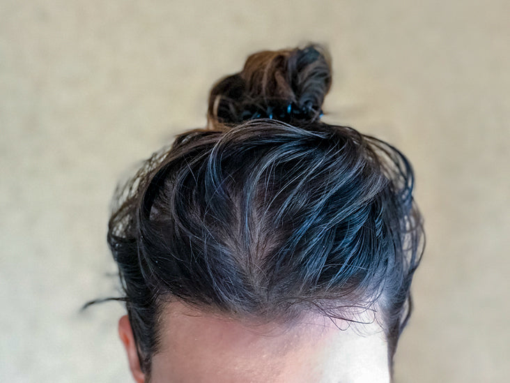 How to manage a greasy scalp